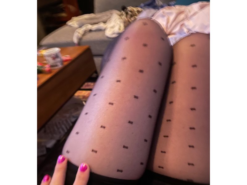 S*** Pics of my Body image 3
